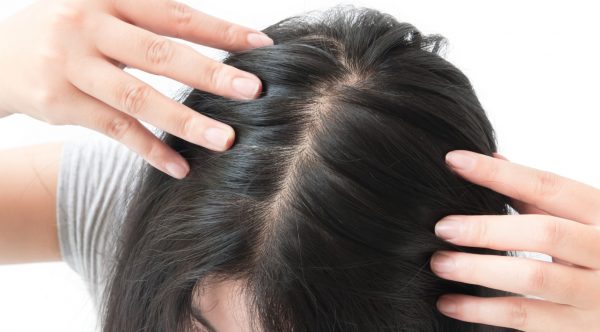 wide part black hair woman telogen effluvium hair loss viviscal hair blog